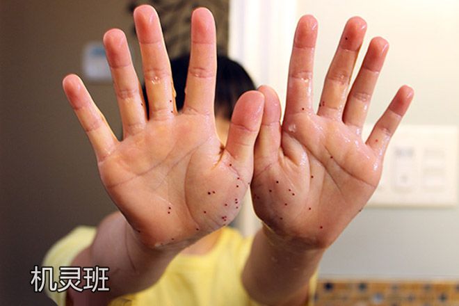 游戏手汗_手机游戏出手汗_手汗 手机游戏