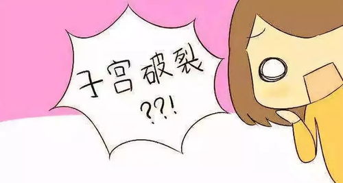 子宫脱出宫交游戏,宫交游戏背后的秘密与启示